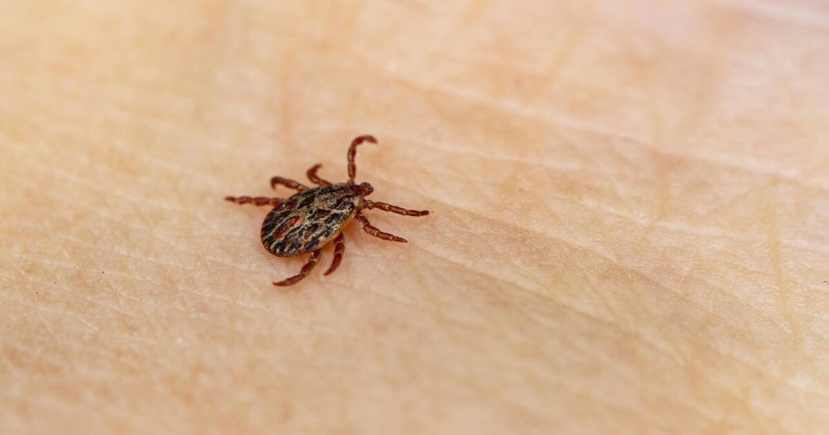 Rocky Mountain Spotted Fever - Imperial County Public Health Department